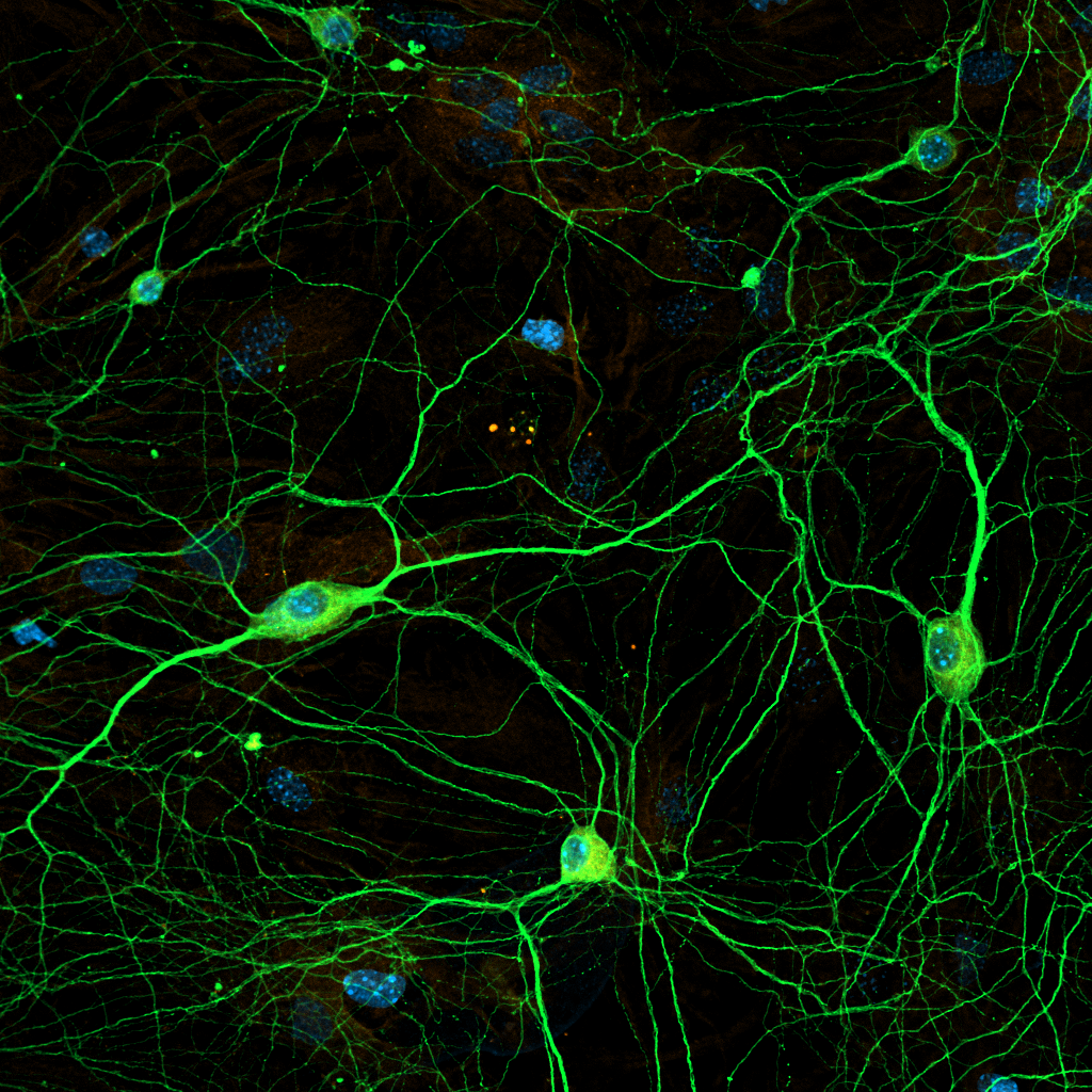 Нейроны, астроциты и ядра